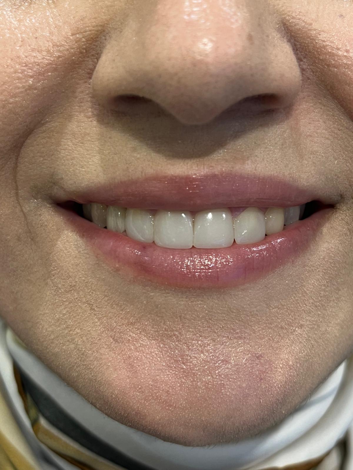 ECE Dental Patient Transformation